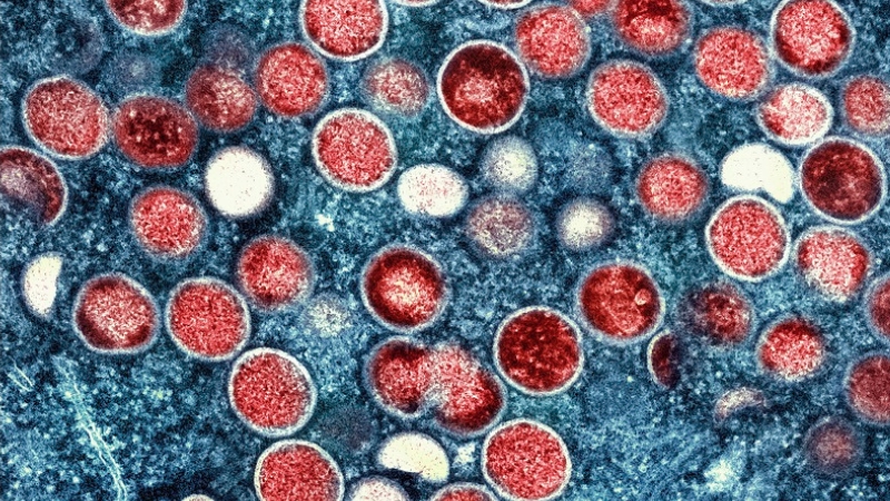 O que é o Mpox?
